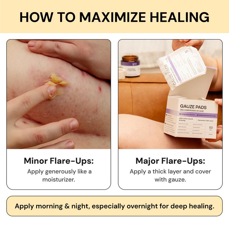 MagicHeal™ Universal Flare Care