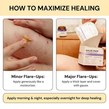 MagicHeal™ Universal Flare Care